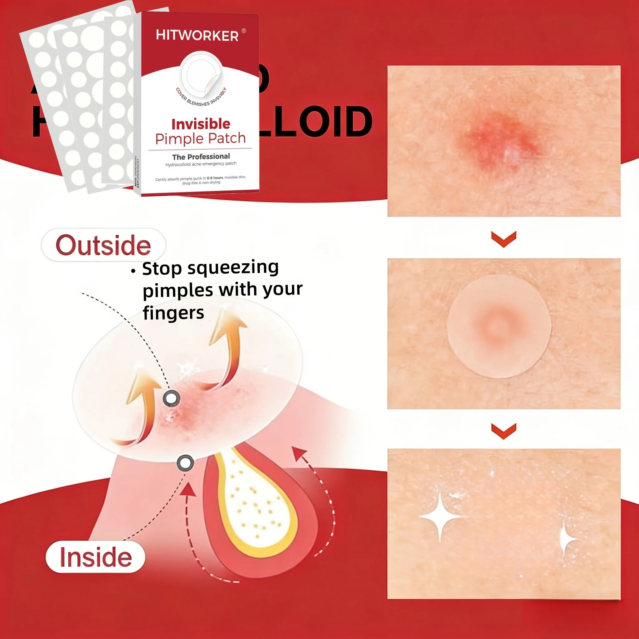 360/540/720PCS Day & Night Acne Patches for Face, Covers Zits & Blemishes, Safe & Gentle, Lightweight & Comfortable