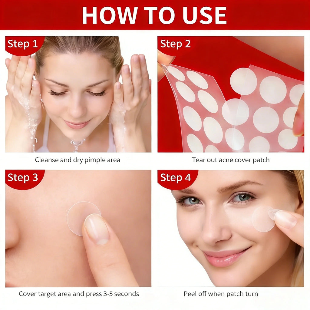 360/540/720PCS Day & Night Acne Patches for Face, Covers Zits & Blemishes, Safe & Gentle, Lightweight & Comfortable